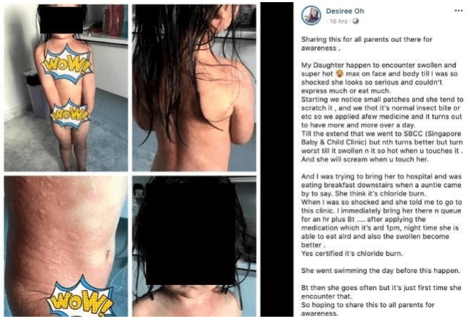 Phat ban vi clo nuoc ho boi 2