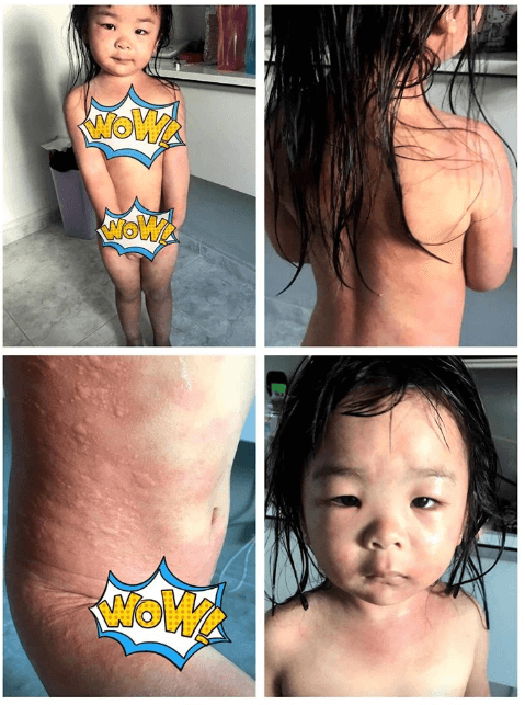 Phat ban vi clo nuoc ho boi 4