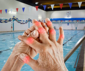 Bơi lội: Một phương pháp điều trị tự nhiên cho người bị viêm khớp dạng thấp 8 Boi loi Mot phuong phap dieu tri tu nhien cho nguoi bi viem khop dang thap 8084D4EF 82D3 4BC1 80E4 D06E457D1956